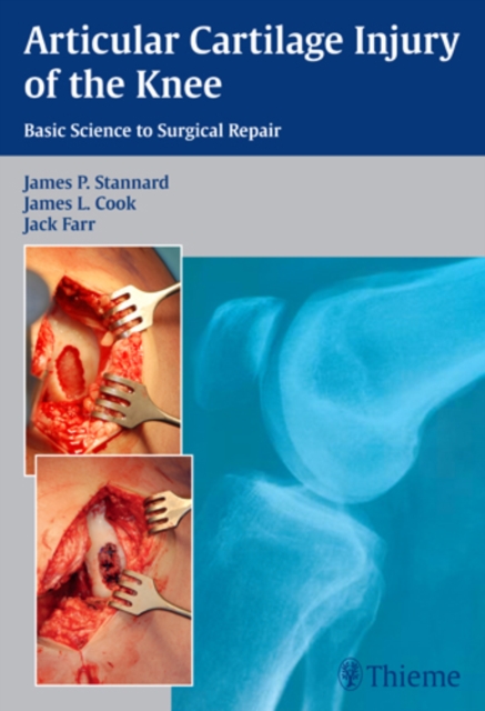 Articular Cartilage Injury of the Knee: Basic Science to Surgical Repair, Hardback Book