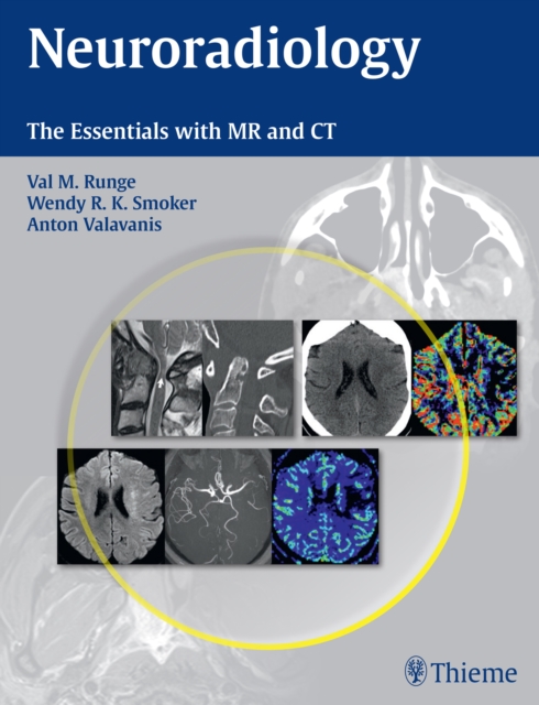 Neuroradiology : The Essentials with MR and CT, Paperback / softback Book
