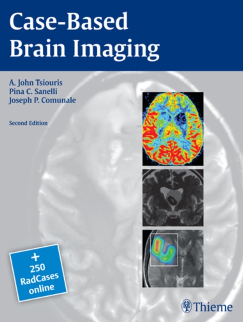 Case-Based Brain Imaging, Paperback / softback Book