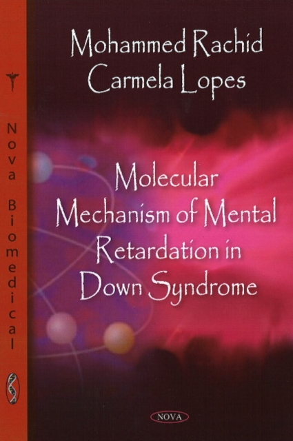 Molecular Mechanism of Mental Retardation in Down Syndrome, Paperback / softback Book