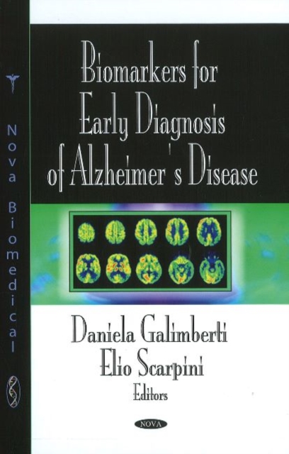 Biomarkers for Early Diagnosis of Alzheimer's Disease, Hardback Book