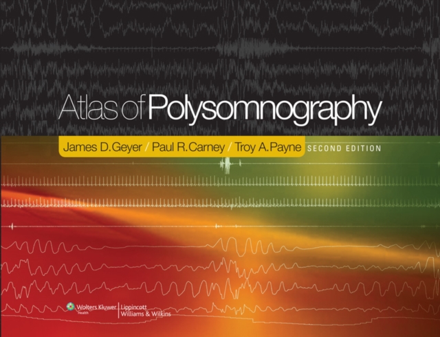 Atlas of Polysomnography, Hardback Book