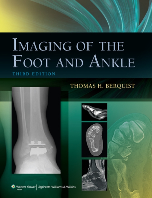 Imaging of the Foot and Ankle, Hardback Book