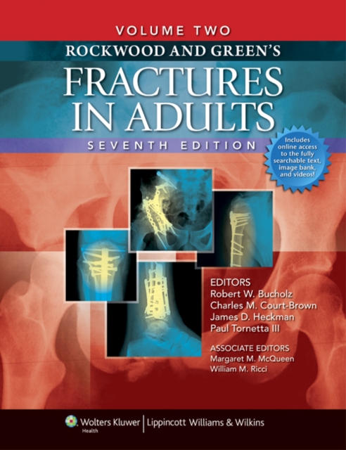 Rockwood and Green's Fractures in Adults : Two Volumes Plus Integrated Content Website (Rockwood, Green, and Wilkins' Fractures), Hardback Book