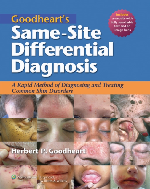 Goodheart's Same-Site Differential Diagnosis: A Rapid Method of Diagnosing and Treating Common Skin Disorders, Hardback Book