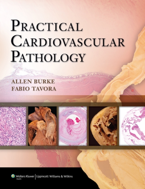 Practical Cardiovascular Pathology, Hardback Book