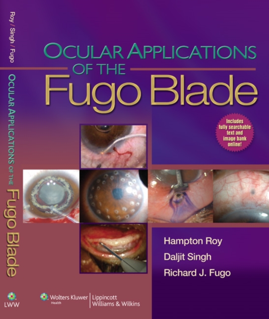 Ocular Applications of the Fugo Blade, Hardback Book