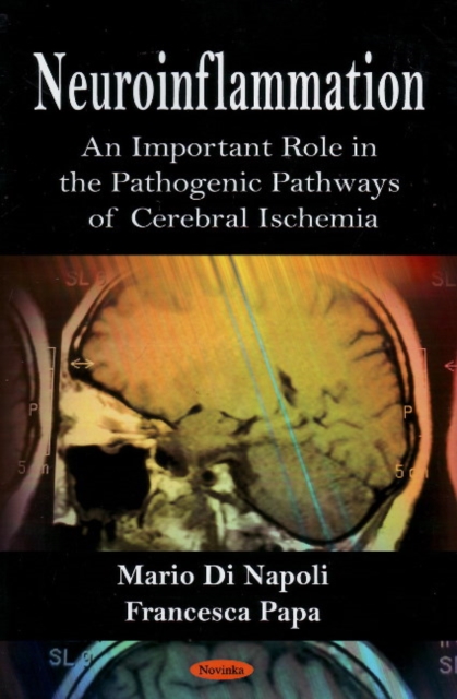 Neuroinflammation : An Important Role in the Pathogenic Pathways of Cerebral Ischemia, Paperback / softback Book