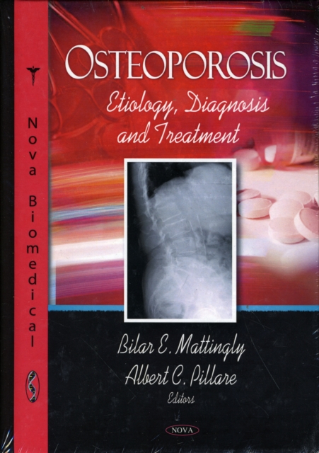 Osteoporosis : Etiology, Diagnosis & Treatment, Hardback Book