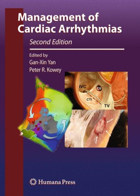 Management of Cardiac Arrhythmias, Hardback Book