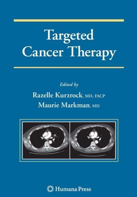Targeted Cancer Therapy, Paperback / softback Book