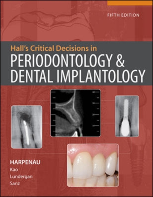 Hall's Critical Decisions in Periodontology, Hardback Book