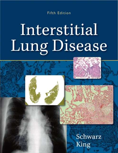Interstitial Lung Disease, EPUB eBook