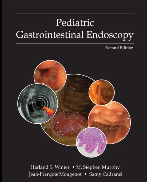 Pediatric Gastrointestinal Endoscopy, EPUB eBook