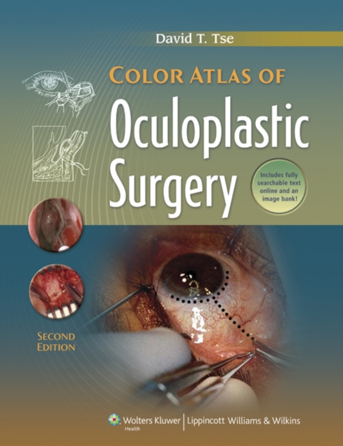 Color Atlas of Oculoplastic Surgery, Hardback Book