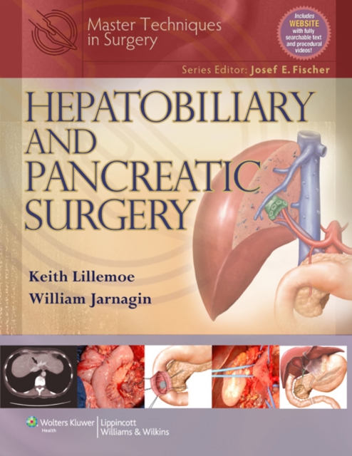 Master Techniques in Surgery: Hepatobiliary and Pancreatic Surgery, Hardback Book