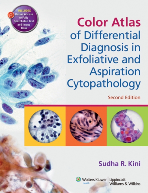Color Atlas of Differential Diagnosis in Exfoliative and Aspiration Cytopathology, Hardback Book