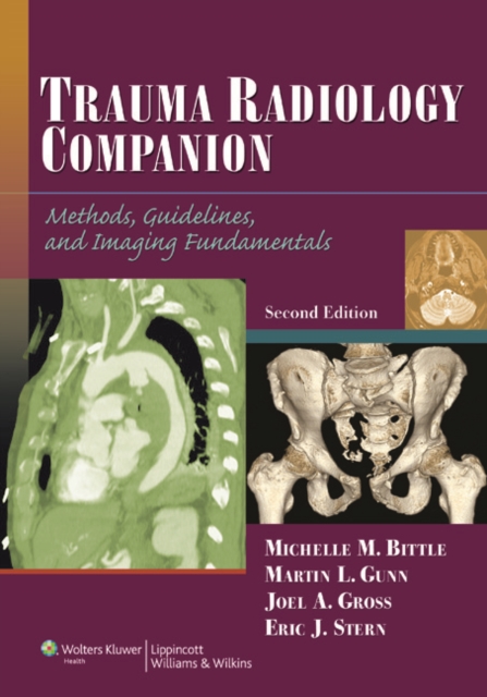 Trauma Radiology Companion : Methods, Guidelines, and Imaging Fundamentals, Paperback / softback Book