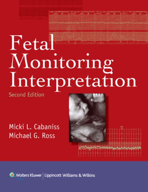Fetal Monitoring Interpretation, Hardback Book