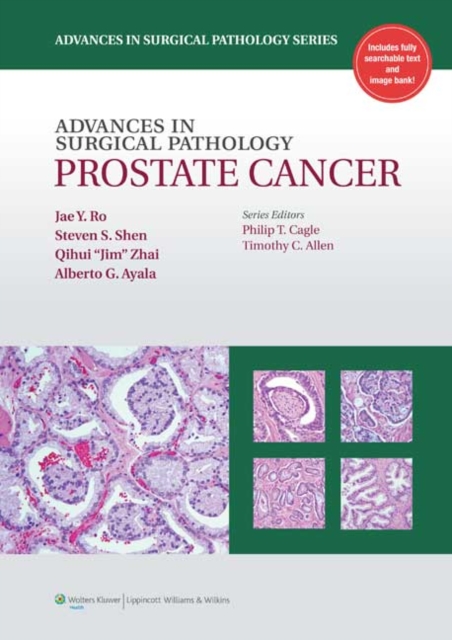 Advances in Surgical Pathology: Prostate Cancer, Hardback Book