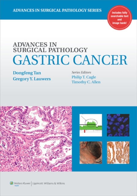 Advances in Surgical Pathology: Gastric Cancer, Hardback Book