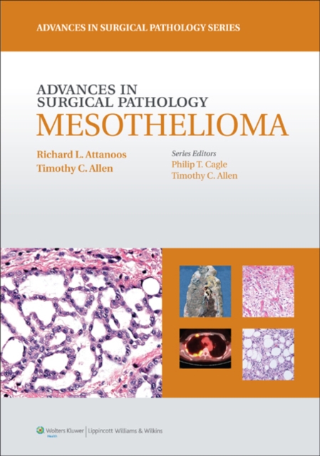 Advances in Surgical Pathology: Mesothelioma, Hardback Book