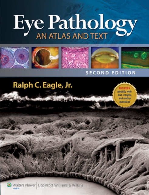Eye Pathology: An Atlas and Text, Hardback Book
