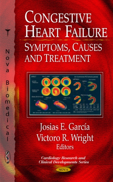 Congestive Heart Failure : Symptoms, Causes & Treatment, Hardback Book