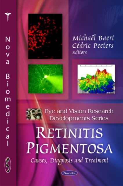 Retinitis Pigmentosa : Causes, Diagnosis & Treatment, Paperback / softback Book