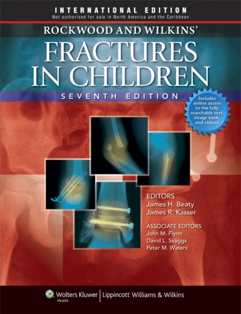 Rockwood, Green, and Wilkins' Fractures : Three Volumes Plus Integrated Content Website, Hardback Book