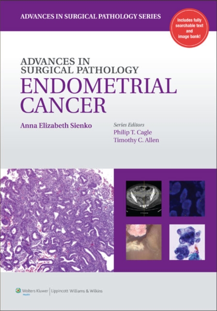 Advances in Surgical Pathology: Endometrial Carcinoma, Hardback Book