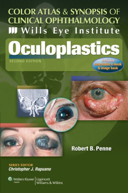 Wills Eye Institute - Oculoplastics, Paperback Book