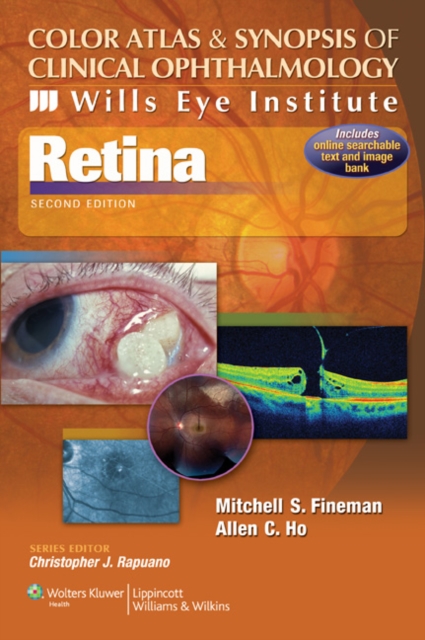 Color Atlas and Synopsis of Clinical Ophthalmology -- Wills Eye Institute -- Retina, Paperback Book