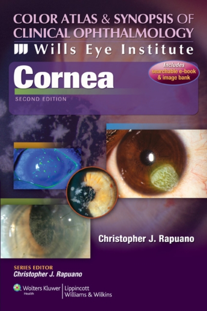 Wills Eye Institute - Cornea, Paperback Book