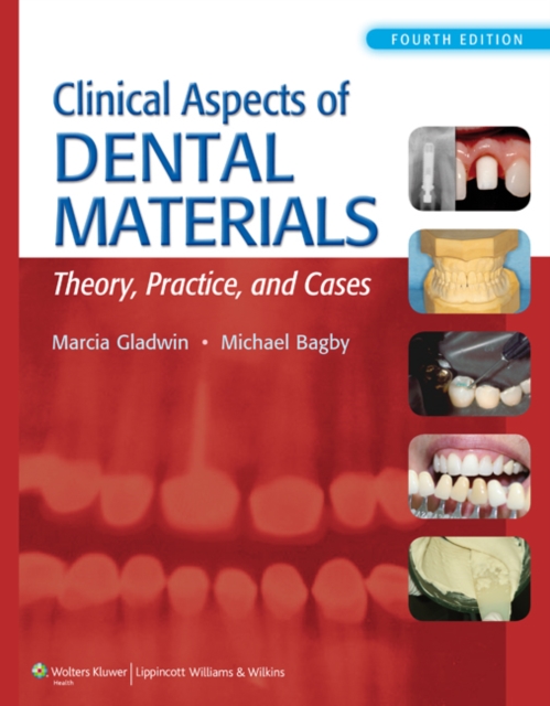 Clinical Aspects of Dental Materials, Paperback Book