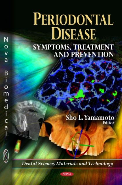 Periodontal Disease : Symptoms, Treatment and Prevention, PDF eBook
