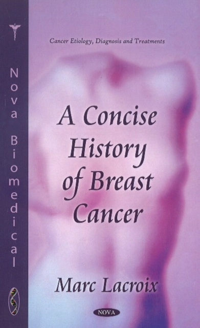 Concise History of Breast Cancer, Hardback Book