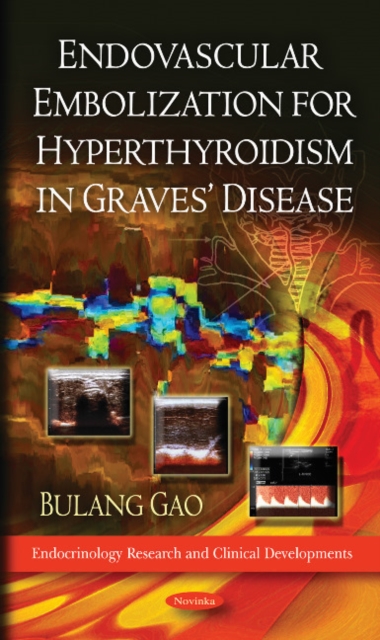 Endovascular Embolization for Hyperthyroidism in Graves' Disease, Paperback / softback Book
