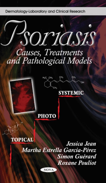 Psoriasis : Causes, Treatments & Pathological Models, Paperback / softback Book