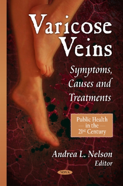 Varicose Veins : Symptoms, Causes & Treatments, Hardback Book