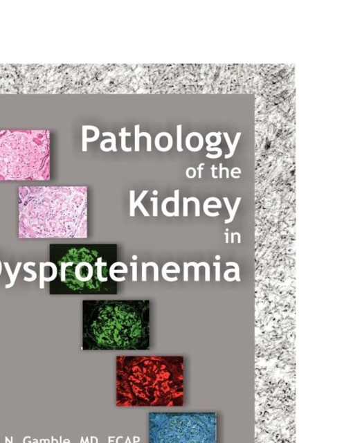 Pathology of the Kidney in Dysproteinemia, Paperback / softback Book