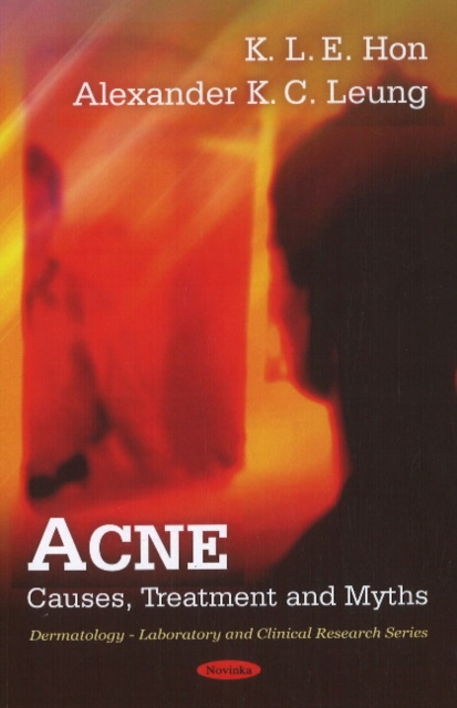 Acne : Causes, Treatment & Myths, Paperback / softback Book
