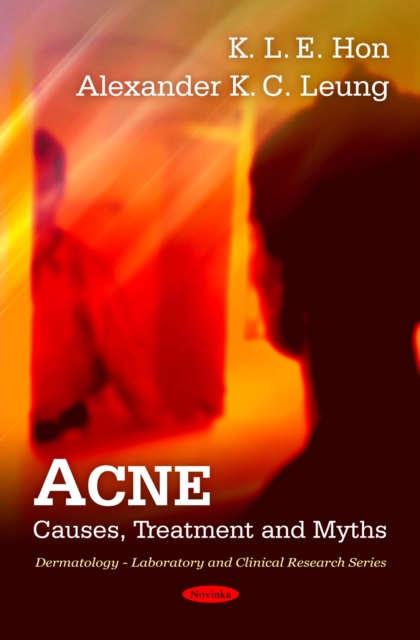 Acne : Causes, Treatment and Myths, PDF eBook