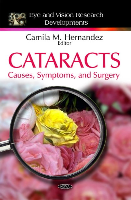 Cataracts : Causes, Symptoms, & Surgery, Hardback Book