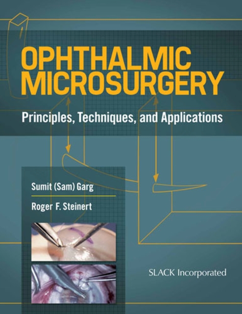 Ophthalmic Microsurgery : Principles, Techniques, and Applications, Spiral bound Book