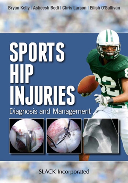 Sports Hip Injuries : Diagnosis and Management: Bryan Kelly ...