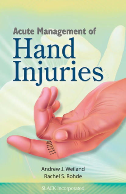 Acute Management of Hand Injuries, EPUB eBook