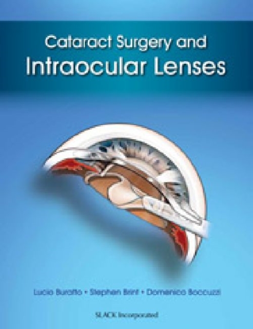 Cataract Surgery and Intraocular Lenses, Hardback Book