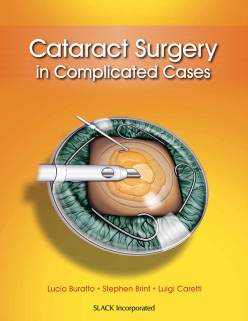Cataract Surgery in Complicated Cases, Hardback Book