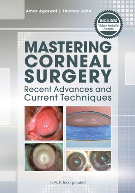 Mastering Corneal Surgery : Recent Advances and Current Techniques, Paperback / softback Book